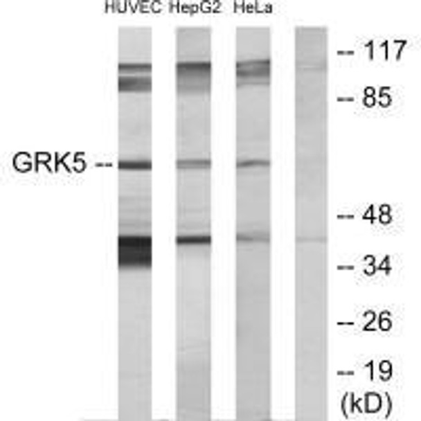 GRK5 Antibody (PACO21774)