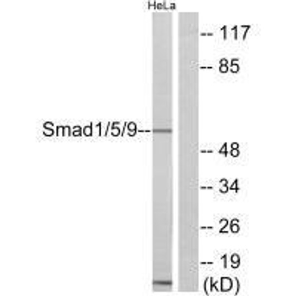 SMAD1 Antibody (PACO21863)