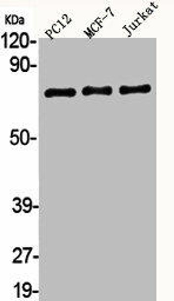 AKAP8 Antibody (PACO06241)
