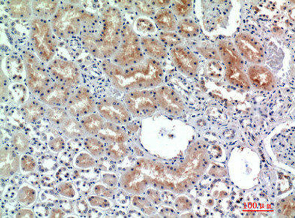 DPP4 Antibody (PACO07222)