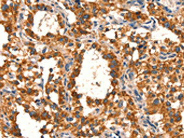 EPO Antibody (PACO19609)