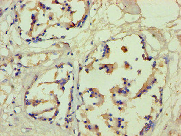 FLG Antibody (PACO26789)