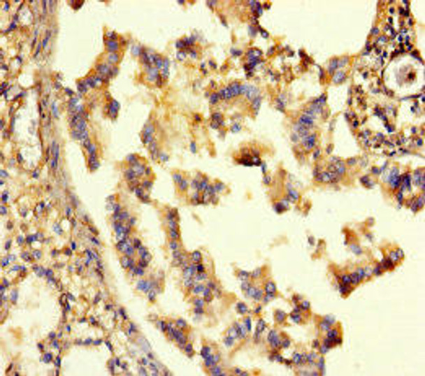 GABRA6 Antibody (PACO35722)