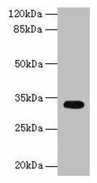 CYB5R2 Antibody (PACO36670)