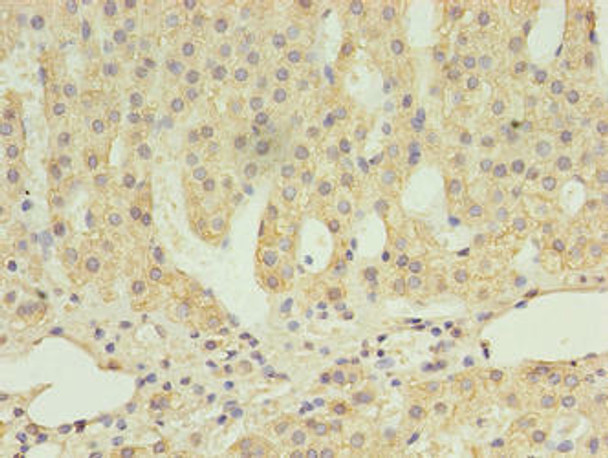 SCARB1 Antibody (PACO39198)