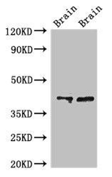 CAMK1 Antibody (PACO50502)