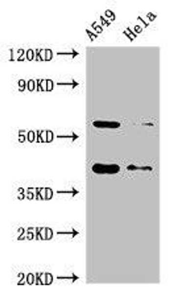 SMN1 Antibody (PACO50510)