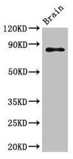 GIT1 Antibody (PACO51550)