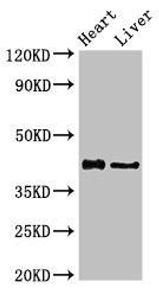 HDAC8 Antibody (PACO51610)