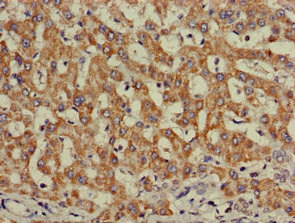 INSR Antibody (PACO51650)