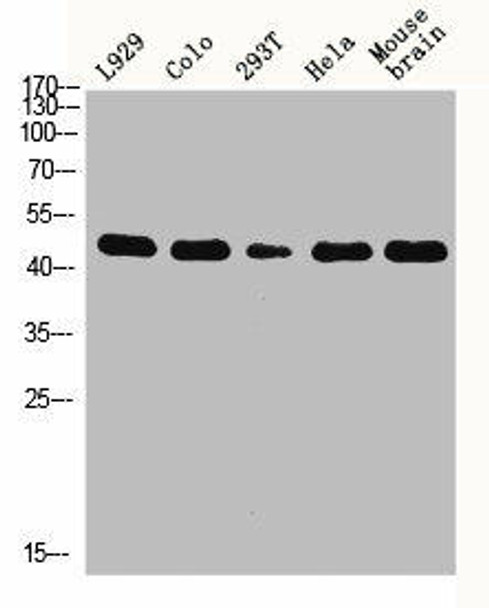 KRT18 Antibody (PACO06413)