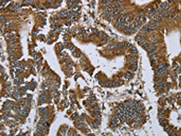 PRDM2 Antibody (PACO19917)