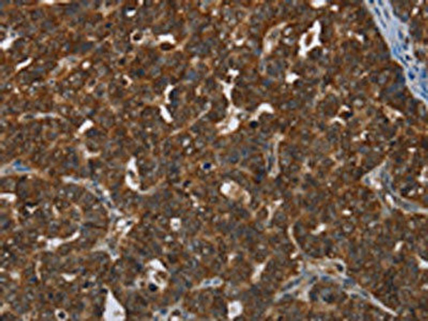 CERS5 Antibody (PACO19929)