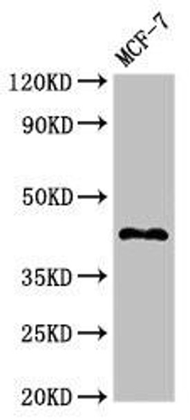 TMEM173 Antibody (PACO52006)