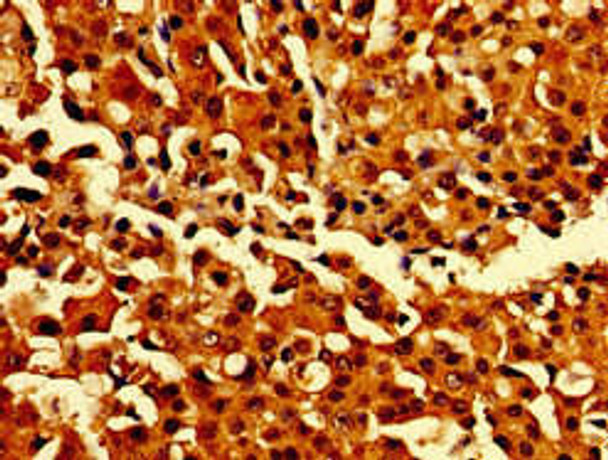 CARD14 Antibody (PACO54578)