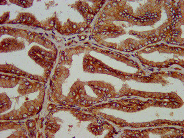 SLC14A1 Antibody (PACO57112)