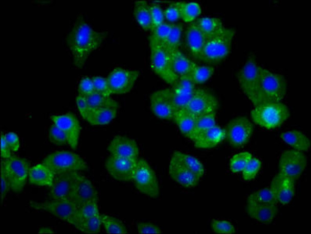 TMEM132D Antibody (PACO58945)