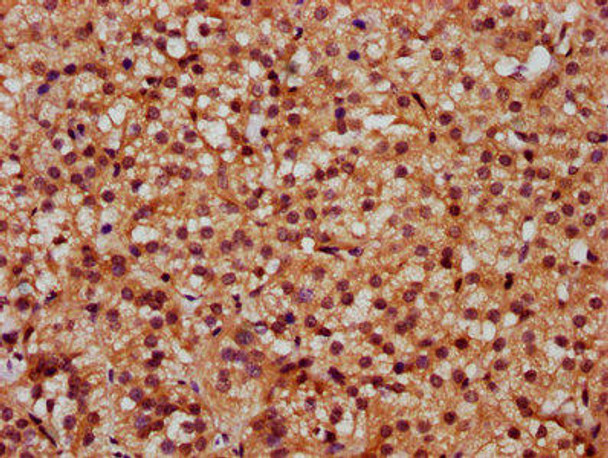 SLC26A2 Antibody (PACO59888)
