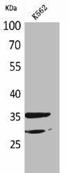 IL2RA Antibody (PACO01951)