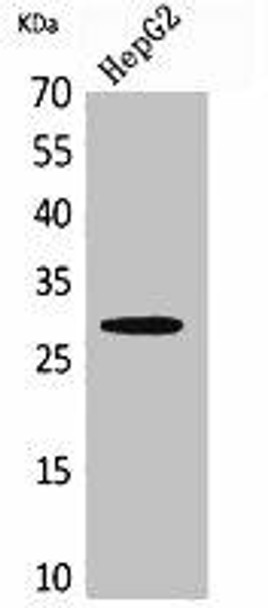 CD69 Antibody (PACO02138)