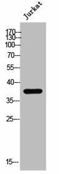 ZDHHC15 Antibody (PACO02551)