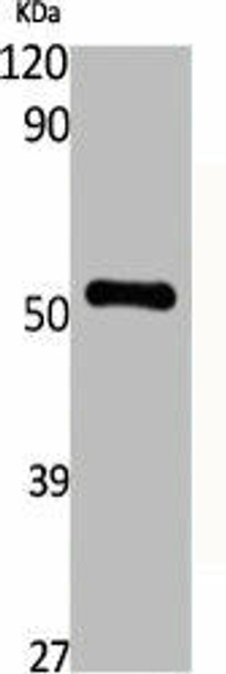 KRT13 Antibody (PACO06410)