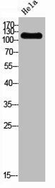 PIK3CA Antibody (PACO06746)