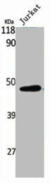 RAD52 Antibody (PACO06791)