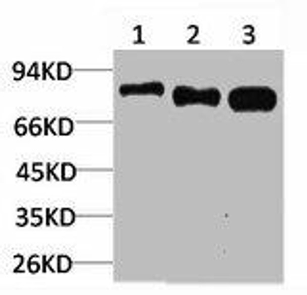 RPS6KB1 Antibody (PACO07039)