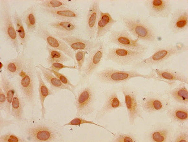 Di-methyl-HIST1H3A (K4) Antibody (PACO56530)