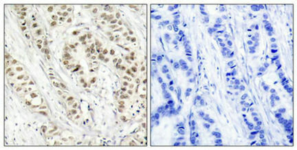 Phospho-BRCA1 (Ser1524) Antibody (PACO23856)
