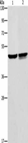 AMACR Antibody (PACO14019)