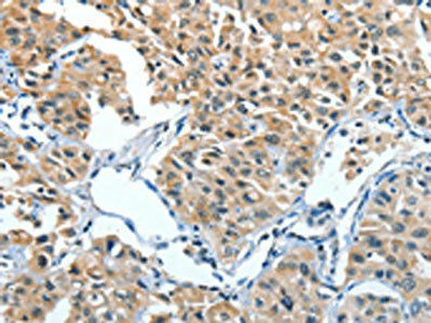 ANGPT1 Antibody (PACO14031)