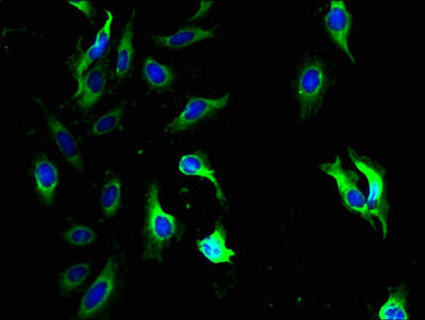 QPCTL Antibody (PACO40906)