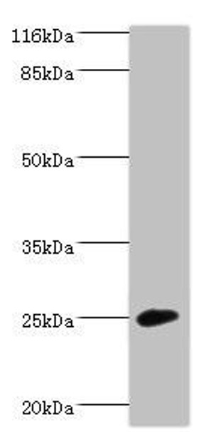 CALN1 Antibody (PACO41002)