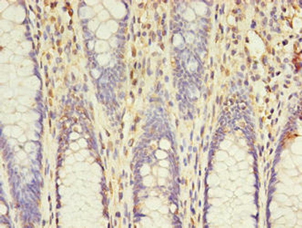 ACSL5 Antibody (PACO42430)