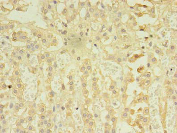 RIPK3 Antibody (PACO42842)