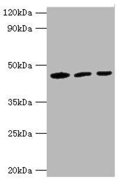 IDH1 Antibody (PACO42912)