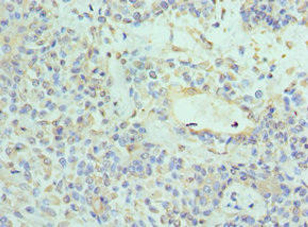 NTRK3 Antibody (PACO43047)