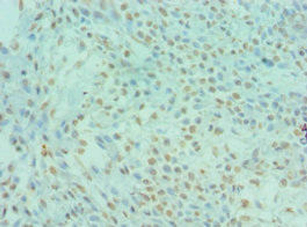 DYRK2 Antibody (PACO43181)