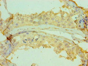 CETN2 Antibody (PACO43188)