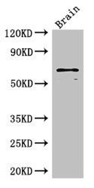 SLC6A3 Antibody (PACO48470)