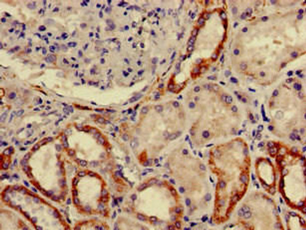 FURIN Antibody (PACO49606)