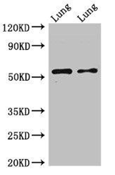 HTR3A Antibody (PACO49674)