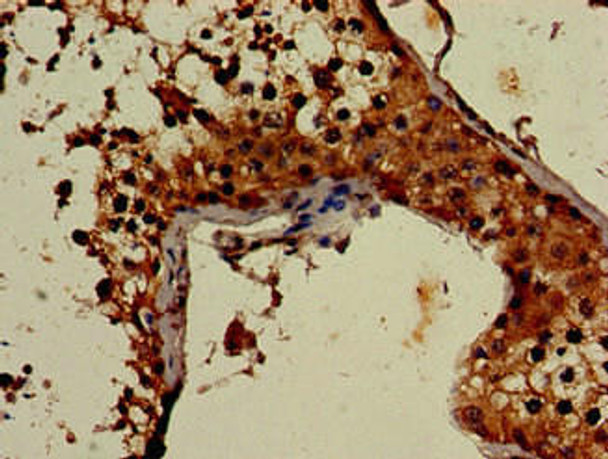 ATG4C Antibody (PACO50826)