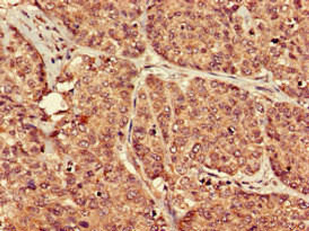 PTGER3 Antibody (PACO51906)