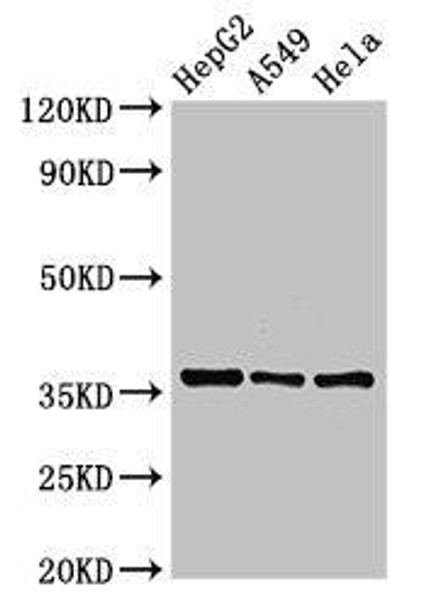 ECH1 Antibody (PACO53098)