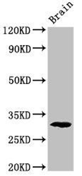 Pdxp Antibody (PACO53714)