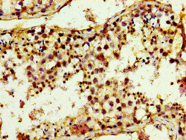 TRIM3 Antibody (PACO55034)