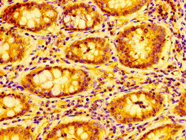 CXCL9 Antibody (PACO56286)